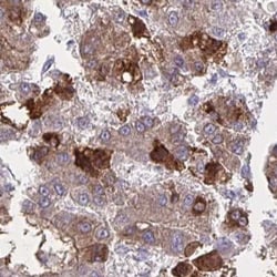 Coagulation Factor II/Thrombin Antibody, Novus Biologicals:Antibodies:Primary