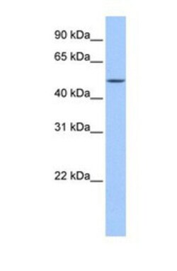 FAAH2 Antibody, Novus Biologicals 0.05mg; Unlabeled:Antibodies, Polyclonal