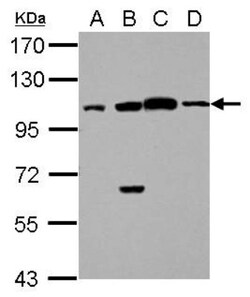 FAAP100 Antibody, Novus Biologicals 0.1mL; Unlabeled:Antibodies, Polyclonal