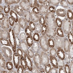 FAAP100 Antibody, Novus Biologicals 0.1mL; Unlabeled:Antibodies, Polyclonal