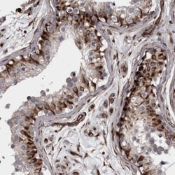 FAAP100 Antibody, Novus Biologicals:Antibodies:Primary Antibodies