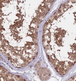 FABP12 Antibody, Novus Biologicals 25 &mu;L | Buy Online | Novus Biologicals | Fisher Scientific