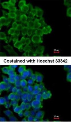 FABP4/A-FABP Antibody, Novus Biologicals 100 &mu;L | Buy Online | Novus Biologicals | Fisher Scientific
