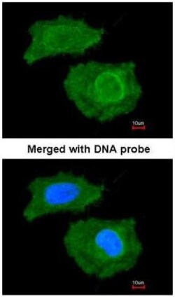 FABP4/A-FABP Antibody, Novus Biologicals 100 &mu;L | Buy Online | Novus Biologicals | Fisher Scientific