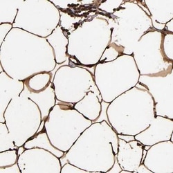 FABP4/A-FABP Antibody, Novus Biologicals 0.1mL; Unlabeled:Antibodies, Polyclonal