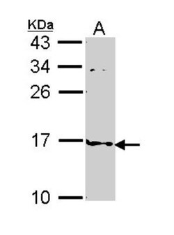 FABP4/A-FABP Antibody, Novus Biologicals 100 &mu;L | Buy Online | Novus Biologicals | Fisher Scientific