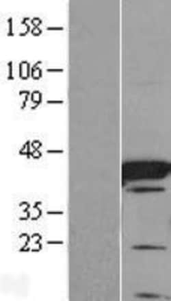 Novus Biologicals&trade;&nbsp;FABP6 Overexpression Lysate