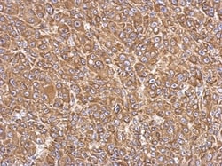 FACL4 Antibody, Novus Biologicals 0.1mL; Unlabeled:Antibodies, Polyclonal