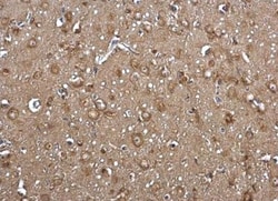 FACL4 Antibody, Novus Biologicals 0.1mL; Unlabeled:Antibodies, Polyclonal