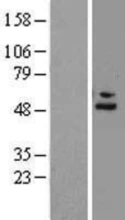 Novus Biologicals&trade;&nbsp;Complement Factor H Overexpression Lysate