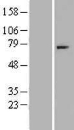 Novus Biologicals™ Complement Factor I Overexpression Lysate