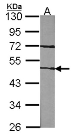 Coagulation Factor VII Antibody, Novus Biologicals 0.1 mL | Buy Online | Novus Biologicals | Fisher Scientific
