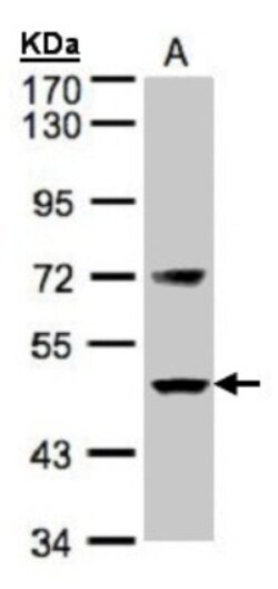 Coagulation Factor VII Antibody, Novus Biologicals 0.1 mL | Buy Online | Novus Biologicals | Fisher Scientific