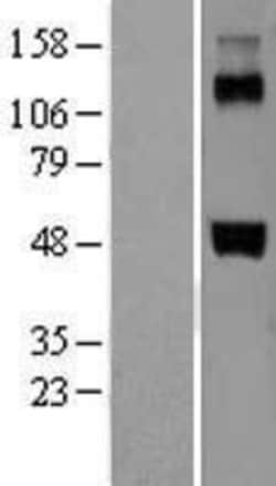 Novus Biologicals&trade;&nbsp;Coagulation Factor VII Overexpression Lysate