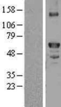 Novus Biologicals™ Coagulation Factor X Overexpression Lysate
