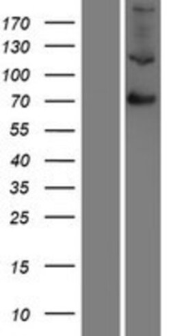 Novus Biologicals™ Factor XIIIb Overexpression Lysate