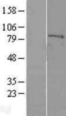 Novus Biologicals&trade;&nbsp;Factor XIIIa Overexpression Lysate