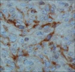 FIH-1/HIF-1AN Antibody (162c), Novus Biologicals 0.1mL; Unlabeled:Antibodies,