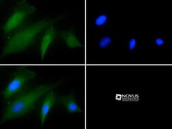 Factor XII Antibody, Novus Biologicals 0.025mL; Unlabeled:Antibodies, Polyclonal