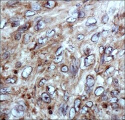Factor XII Antibody, Novus Biologicals 0.025mL; Unlabeled:Antibodies, Polyclonal