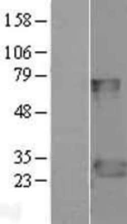 Novus Biologicals&trade;&nbsp;FADD Overexpression Lysate