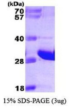 Novus Biologicals&trade;&nbsp;Recombinant Human FADD His Protein