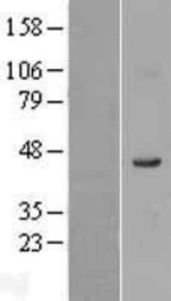 Novus Biologicals&trade;&nbsp;FADS1 Overexpression Lysate
