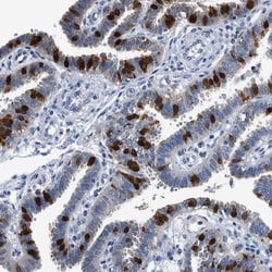 FADS6 Antibody, Novus Biologicals 25 &mu;L, Unlabeled:Antibodies, Polyclonal