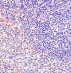 FAF1 Antibody - BSA Free, Novus Biologicals 0.025 mg, Unconjugated:Antibodies,