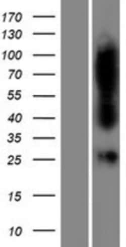 Novus Biologicals&trade;&nbsp;FAHD1 Overexpression Lysate