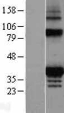 Novus Biologicals&trade;&nbsp;FAHD2A Overexpression Lysate