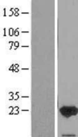 Novus Biologicals&trade;&nbsp;FAIM1 Overexpression Lysate
