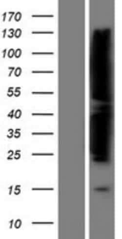 Novus Biologicals&trade;&nbsp;FAK Overexpression Lysate