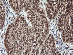 FAK Antibody (OTI4D11), Novus Biologicals 0.1mL; Unlabeled:Antibodies,