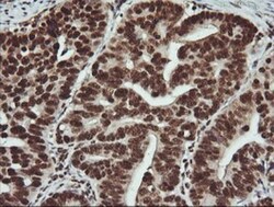 FAK Antibody (OTI4D11), Novus Biologicals 0.1mL; Unlabeled:Antibodies,
