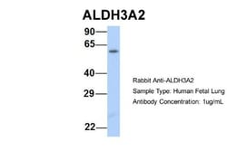 FALDH Antibody, Novus Biologicals 100&mu;L; Unlabeled:Antibodies, Polyclonal