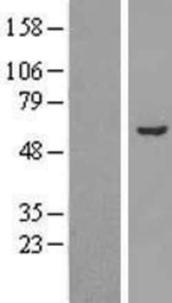 Novus Biologicals&trade;&nbsp;FALDH Overexpression Lysate