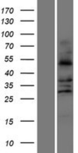 Novus Biologicals&trade;&nbsp;FALDH Overexpression Lysate