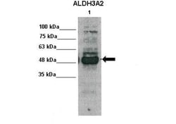 FALDH Antibody, Novus Biologicals 100&mu;L; Unlabeled:Antibodies, Polyclonal