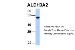 FALDH Antibody, Novus Biologicals 100&mu;L; Unlabeled:Antibodies, Polyclonal