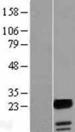 Novus Biologicals&trade;&nbsp;FAM100A Overexpression Lysate