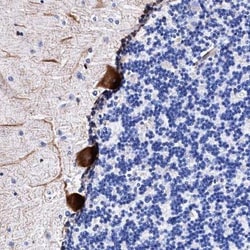 FAM100B Antibody, Novus Biologicals 0.1mL; Unlabeled:Antibodies, Polyclonal