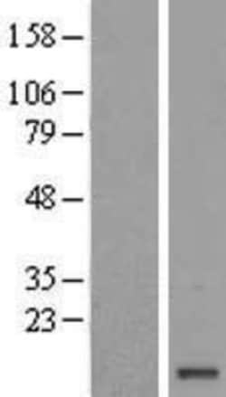 Novus Biologicals&trade;&nbsp;FAM103A1 Overexpression Lysate