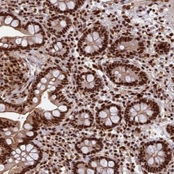 FAM103A1 Antibody, Novus Biologicals:Antibodies:Primary Antibodies