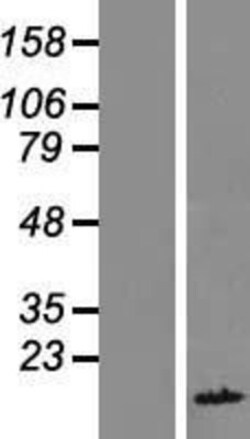 Novus Biologicals&trade;&nbsp;FAM104B Overexpression Lysate