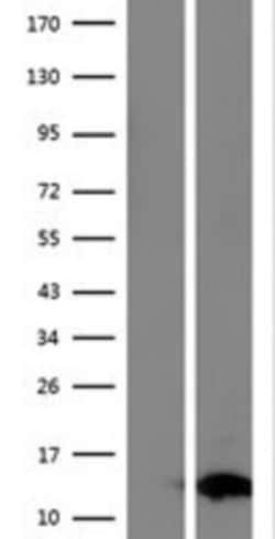 Novus Biologicals™ FAM104B Overexpression Lysate