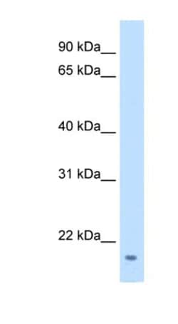 FAM107A Antibody, Novus Biologicals 0.1mg; Unlabeled:Antibodies, Polyclonal