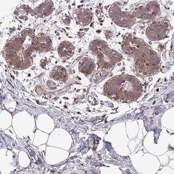 FAM108C1 Antibody, Novus Biologicals 0.1mL; Unlabeled:Antibodies, Polyclonal