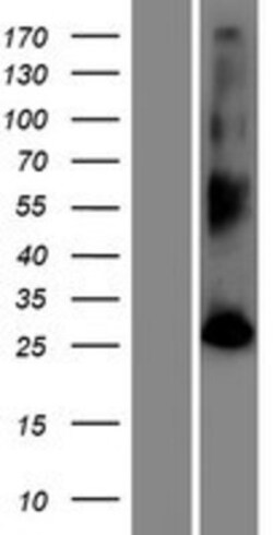 Novus Biologicals&trade;&nbsp;FAM109B Overexpression Lysate