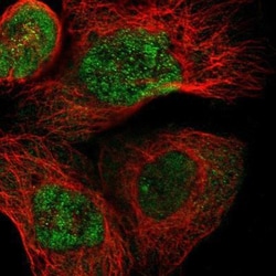 BHMT2 Antibody, Novus Biologicals:Antibodies:Primary Antibodies
